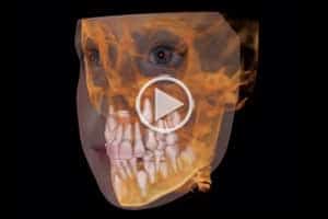 3D imaging Affiliated Orthodontics in Peoria, AZ